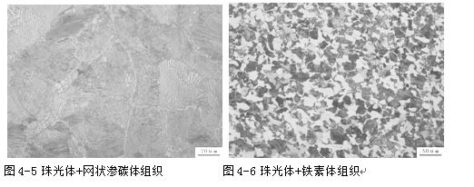 珠光體混合金相組織